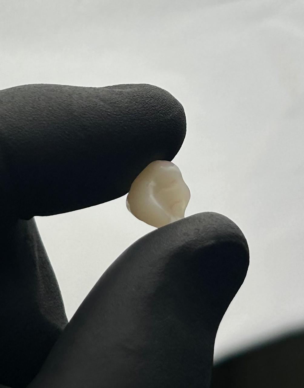 Peça dentária clara segurada por luvas pretas