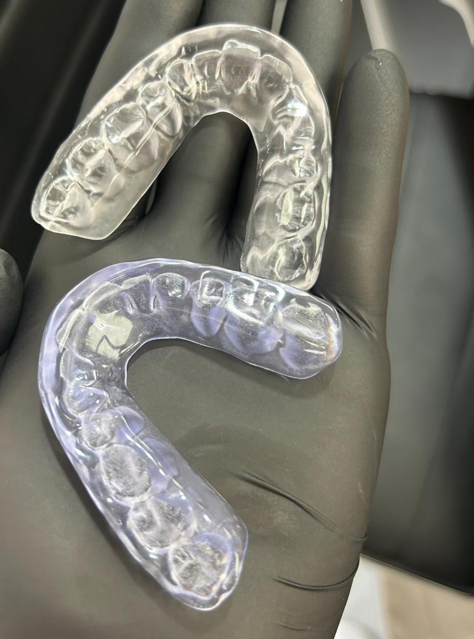 Duas placas odontológicas transparentes apoiadas sobre uma luva