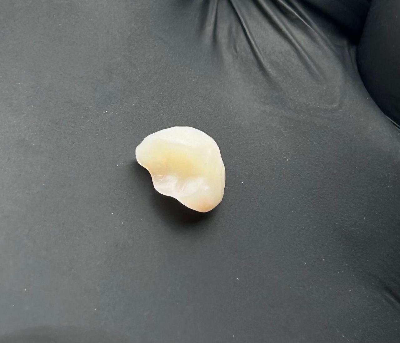 Vista ampliada de peça dentária sobre superfície escura